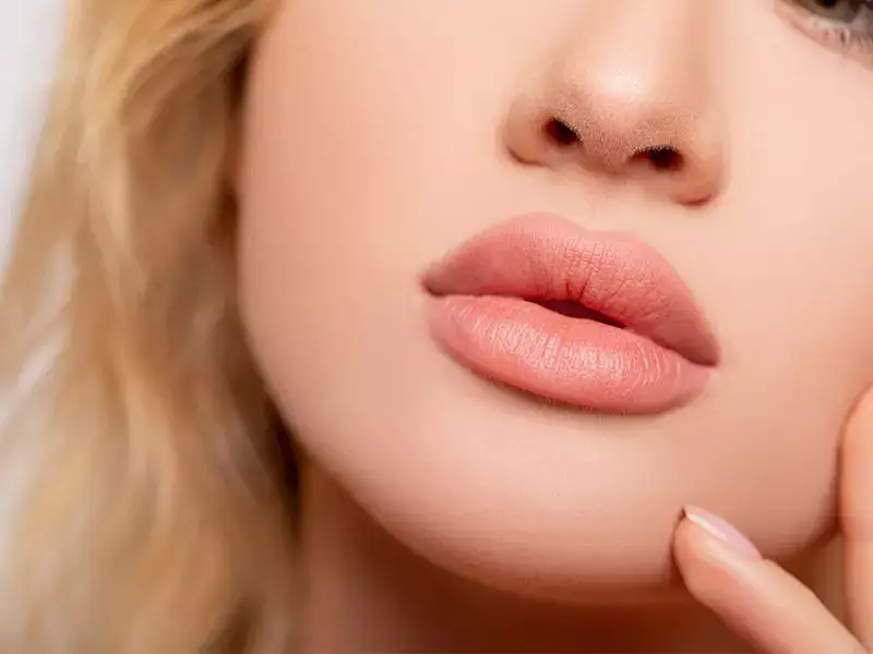 after-lip-filler-treatment