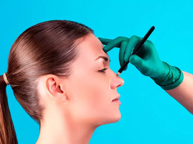 burun-kemeri-duzeltme
