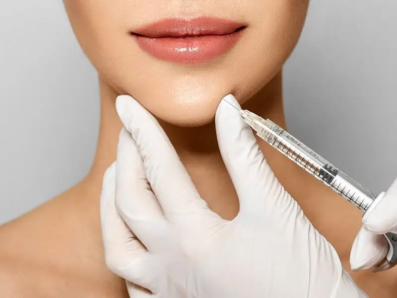 Chin Filling