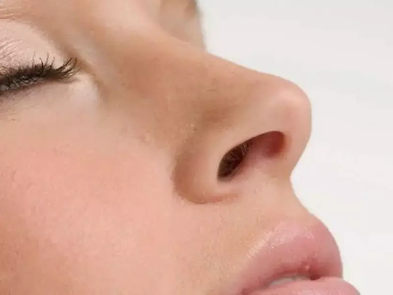 nose-filler-in-eskisehir