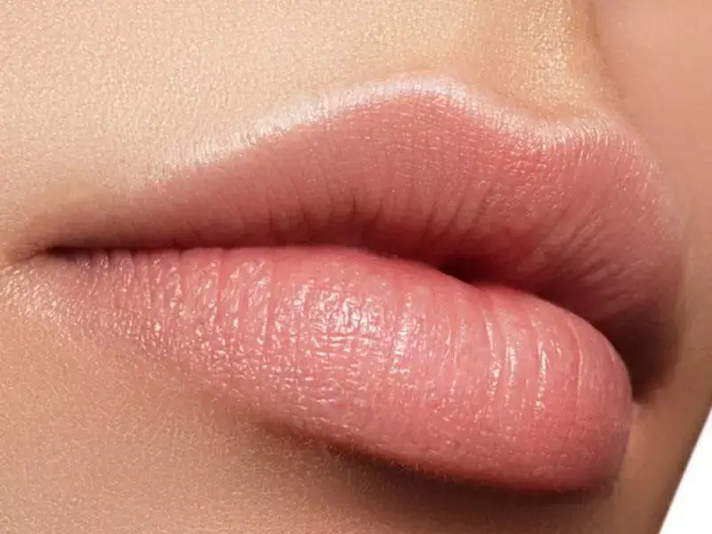 lip-augmentation-procedure-in-eskisehir