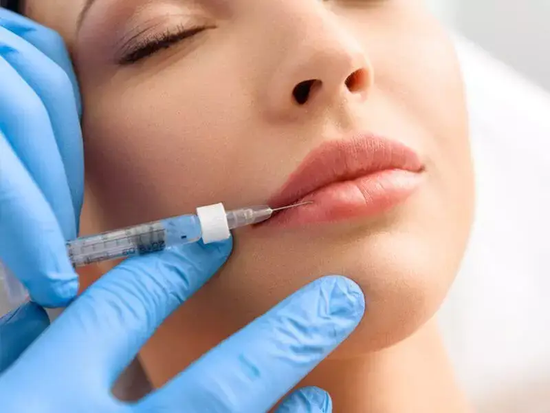 lip-augmentation-in-eskisehir