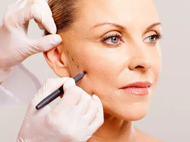 eskisehir-likit-facelift