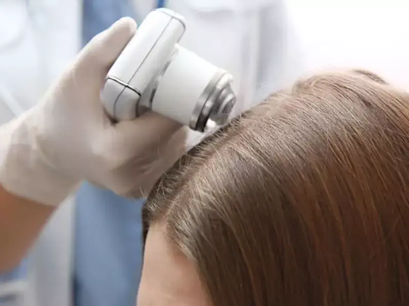 Exosome Hair Mesotherapy