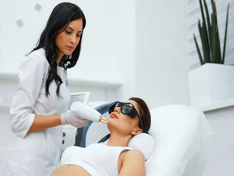 fractional-laser