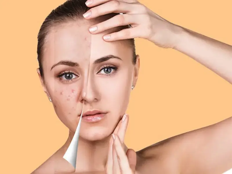 how-is-medical-skin-care-performed