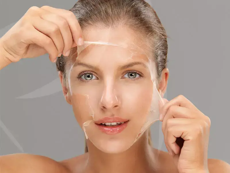 kimyasal-peeling-sonrasi-kahverengi-lekeler