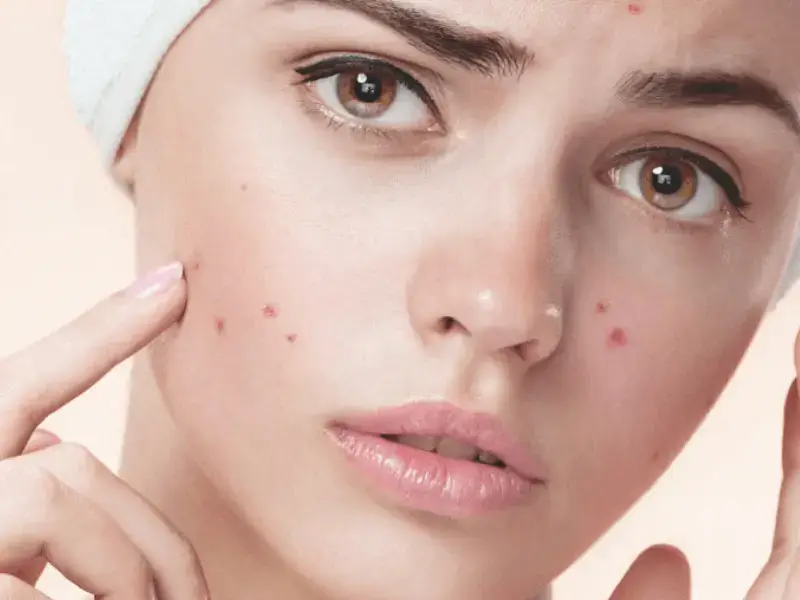 laser-spot-treatment