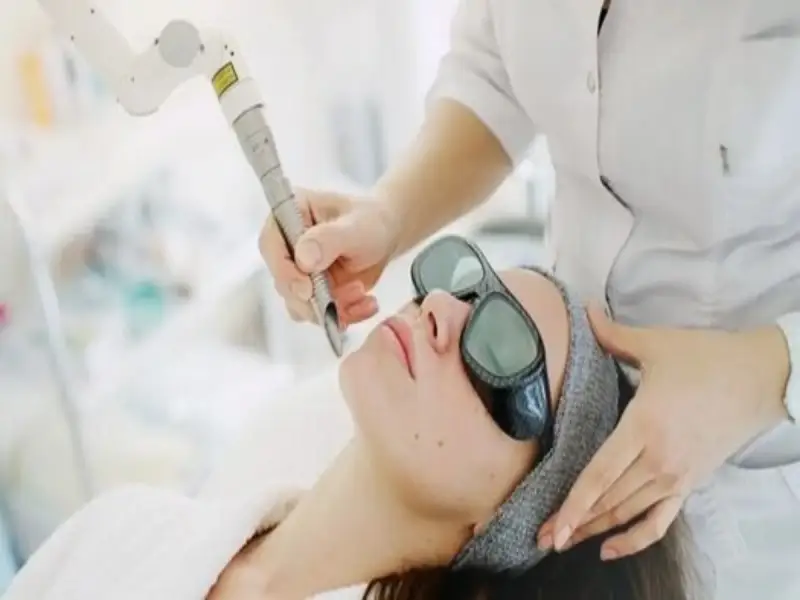 laser-treatment-for-rosacea