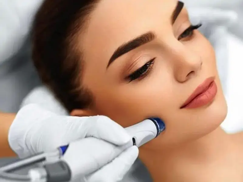 prp-mi-dermapen-mi