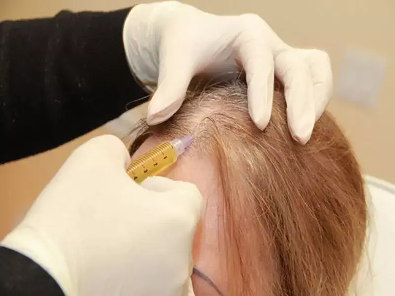 what-is-hair-prp-used-for