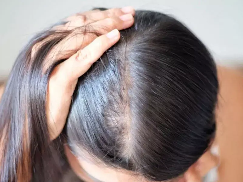 what-is-stem-cell-hair-treatment